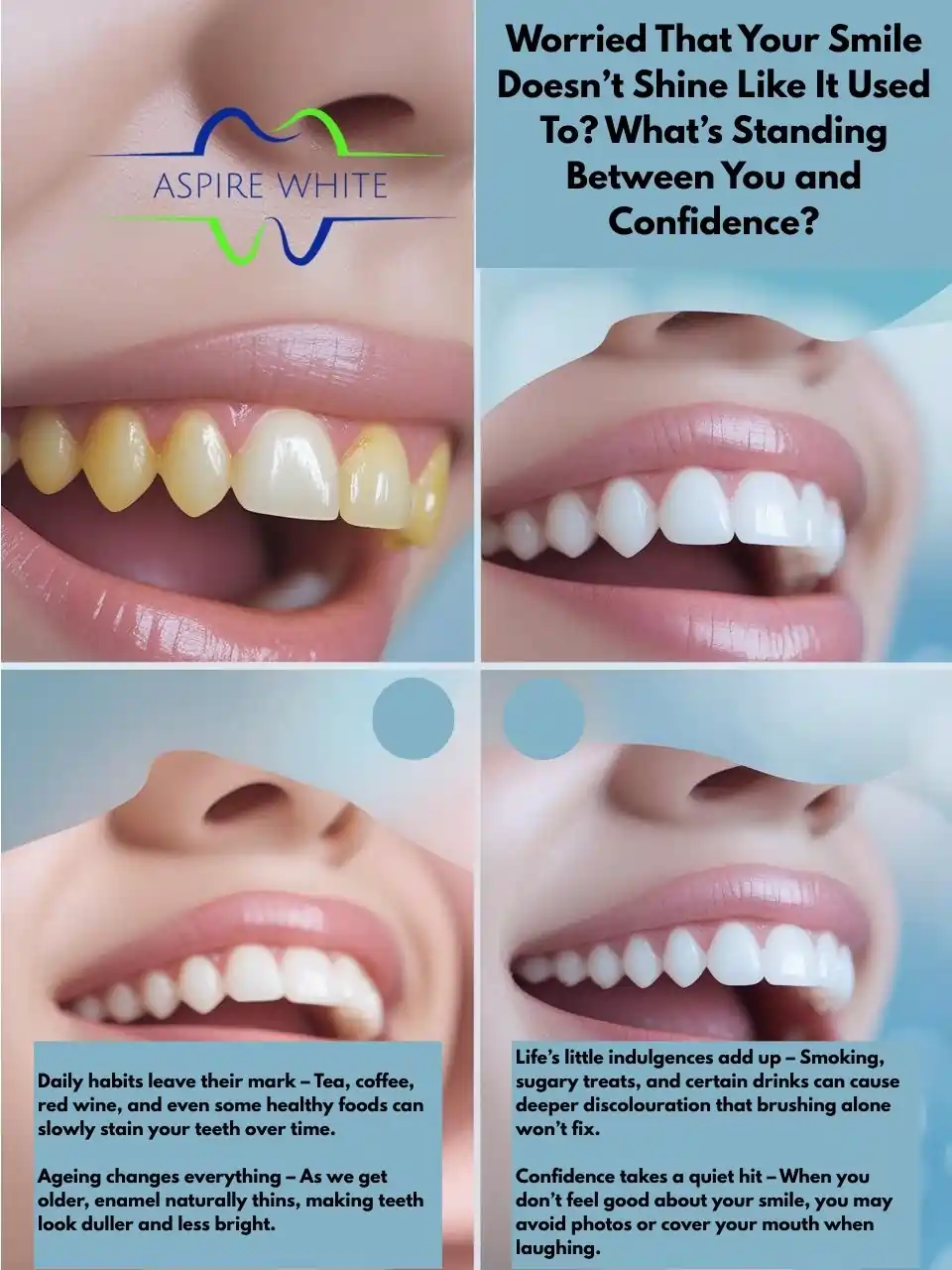 Worried That Your Smile Doesn’t Shine Like It Used To What’s Standing Between You and Confidence Luton